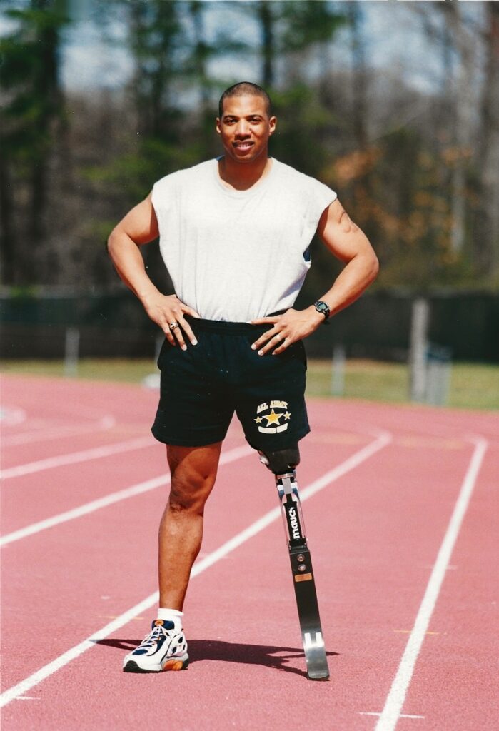 John Register stands with artificial leg